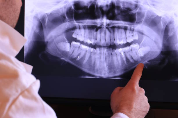 Best Emergency Tooth Extraction  in Concord, AL